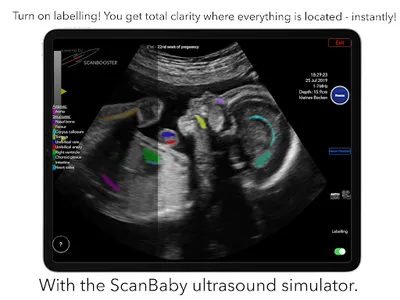 ScanBaby learn baby ultrasound screenshot 16