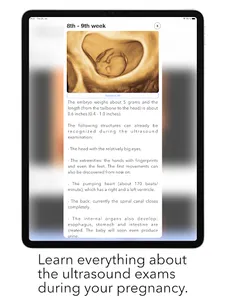 ScanBaby learn baby ultrasound screenshot 17