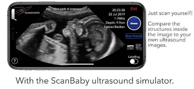 ScanBaby learn baby ultrasound screenshot 2