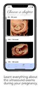 ScanBaby learn baby ultrasound screenshot 4