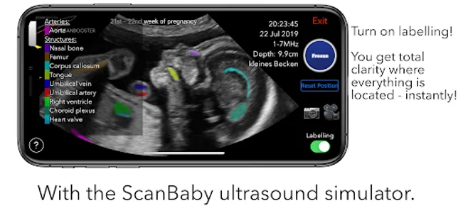 ScanBaby learn baby ultrasound screenshot 5