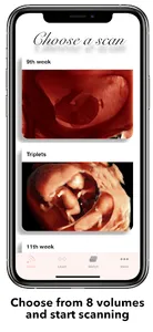 ScanBaby learn baby ultrasound screenshot 7