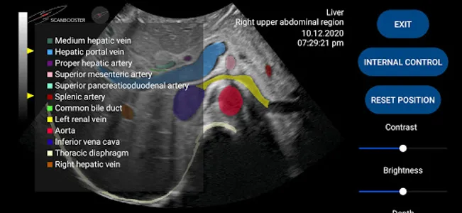 Scanbooster Ultrasound Sim screenshot 0