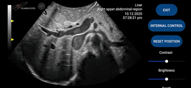 Scanbooster Ultrasound Sim screenshot 1