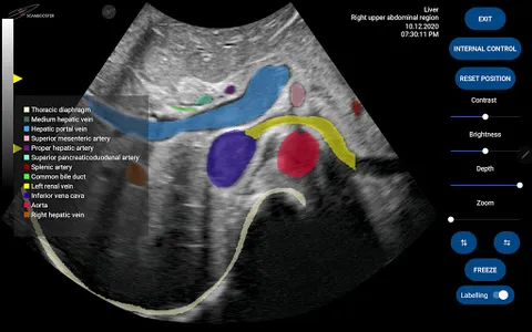 Scanbooster Ultrasound Sim screenshot 6