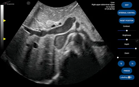 Scanbooster Ultrasound Sim screenshot 7