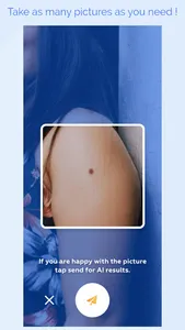 scanoma mole check dermatology screenshot 4