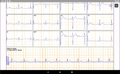 SmartHeart Pro screenshot 13