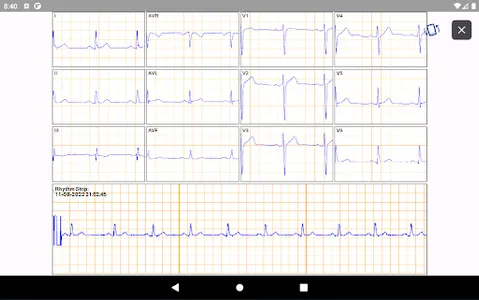 SmartHeart Pro screenshot 8