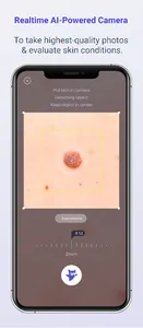 Skinive MD - Skin AI Tracker screenshot 2