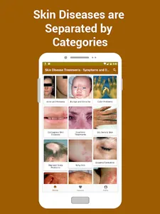 Skin Disease Treatment Symptom screenshot 1