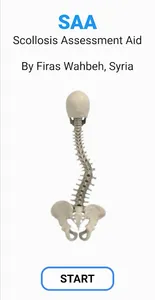 SAA Scoliosis Assessment Aid screenshot 0