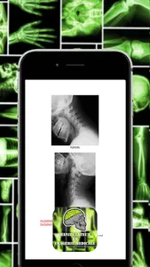 Techniques Radiologiques Osteo screenshot 1