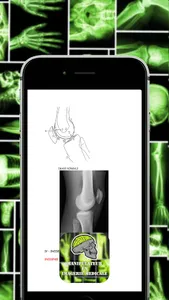 Techniques Radiologiques Osteo screenshot 2