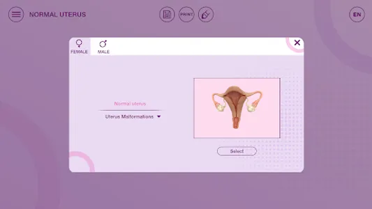 U-Theramex screenshot 0