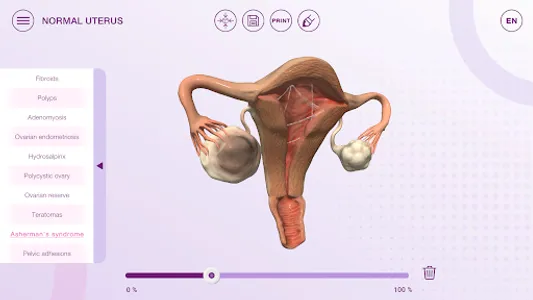 U-Theramex screenshot 1