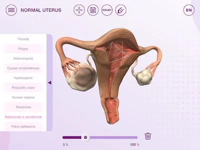 U-Theramex screenshot 11