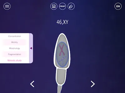 U-Theramex screenshot 13