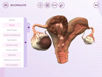 U-Theramex screenshot 14