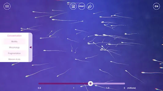 U-Theramex screenshot 2