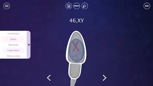 U-Theramex screenshot 3