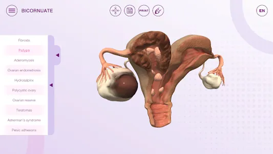 U-Theramex screenshot 4