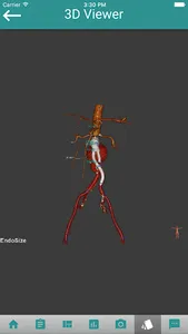 EndoSizeMe screenshot 2