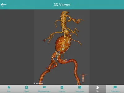 EndoSizeMe screenshot 4