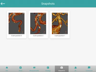 EndoSizeMe screenshot 6