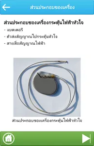 การใส่เครื่องกระตุ้นไฟฟ้าหัวใจ screenshot 3