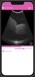 Baby-Scan screenshot 4