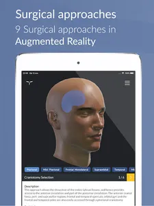 UpSurgeOn Neurosurgery screenshot 12