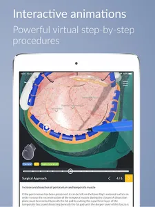 UpSurgeOn Neurosurgery screenshot 15