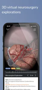 UpSurgeOn Neurosurgery screenshot 4