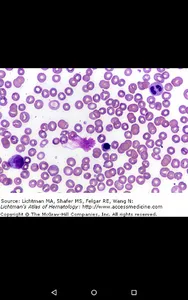Lichtman's Atlas of Hematology screenshot 12