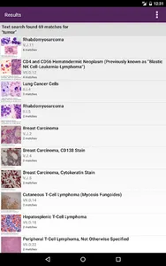 Lichtman's Atlas of Hematology screenshot 14
