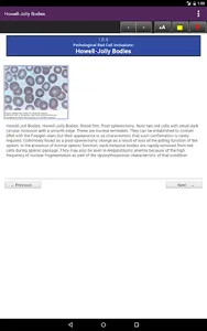 Lichtman's Atlas of Hematology screenshot 19