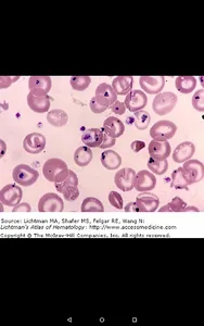 Lichtman's Atlas of Hematology screenshot 20