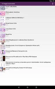 Lichtman's Atlas of Hematology screenshot 23
