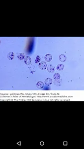 Lichtman's Atlas of Hematology screenshot 4