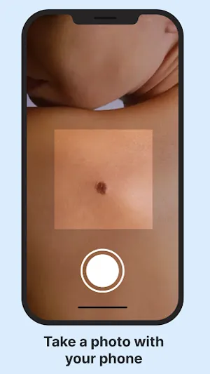 AI Skin Check screenshot 1