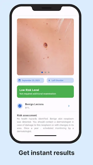 AI Skin Check screenshot 2
