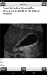 Ultrasound Flashcards Boards F screenshot 2