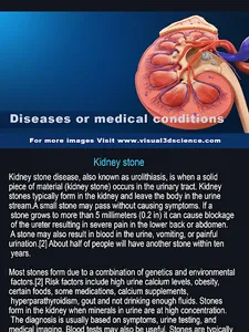 Kidney Anatomy screenshot 14