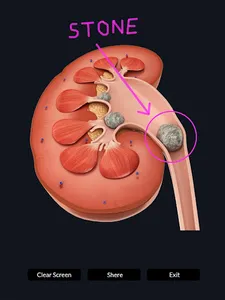 Kidney Anatomy screenshot 15