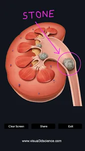 Kidney Anatomy screenshot 6