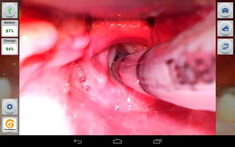 VividVision screenshot 1