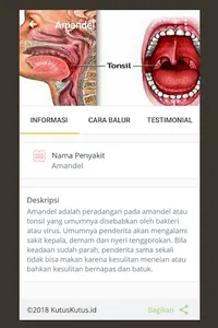 KUTUS KUTUS - Tamba Waras screenshot 3