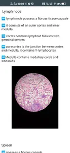 Histo Master screenshot 3