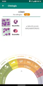 RIN3 - Diagnóstico de rinitis screenshot 6